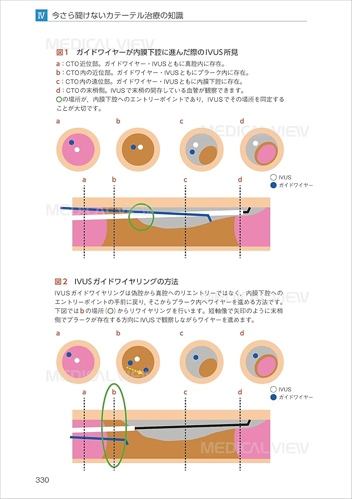 Amazon.co.jp: 今さら聞けない心臓カテーテル 第3版 : 濱嵜 裕司
